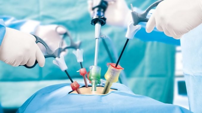 laparoscopic-surgery-innovative-and-safe-surgery-samitivej-hospital