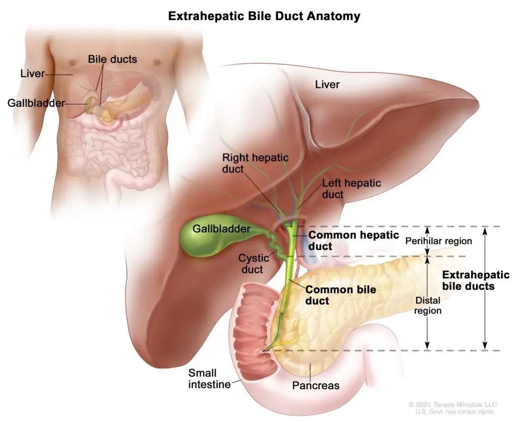 Bile Duct Issues After Gallbladder Removal Injuries to the Intestines and Blood Vessels