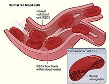 HOW IS ANEMIA DIAGNOSED?
