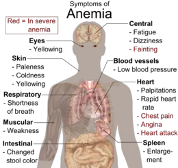 WHAT ARE THE SYMPTOMS OF ANEMIA?