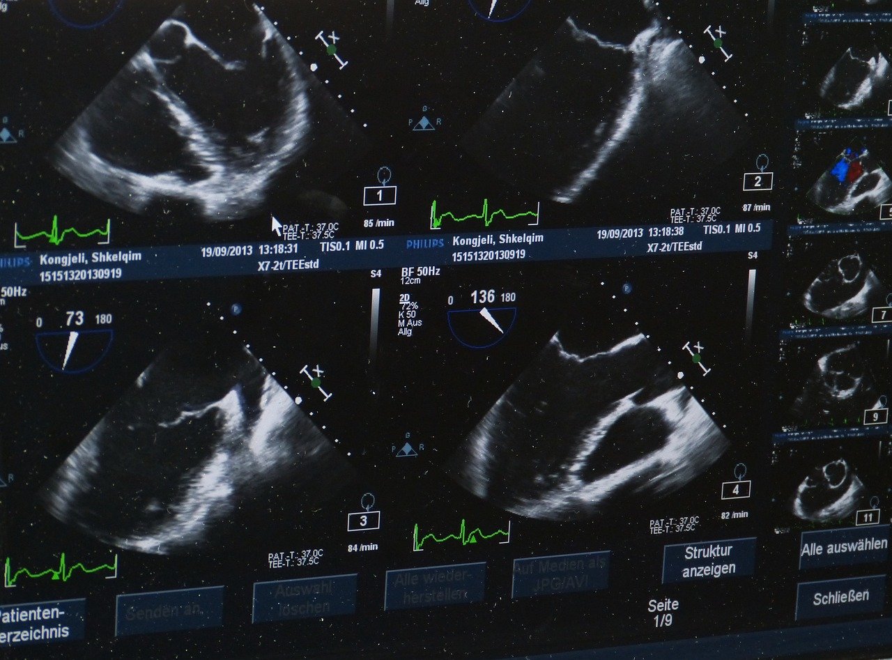 biliary-sludge-causes-and-treatment-gallstone-clinic